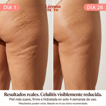 Aceite de Masaje Anti-Celulitis